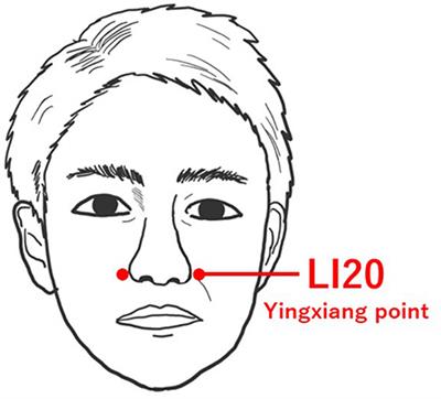 Case Report: Acupuncture is an effective treatment for olfactory dysfunction in the post COVID-19 condition